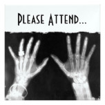 X-Ray Skeleton Hands & Jewelry - B&W Card